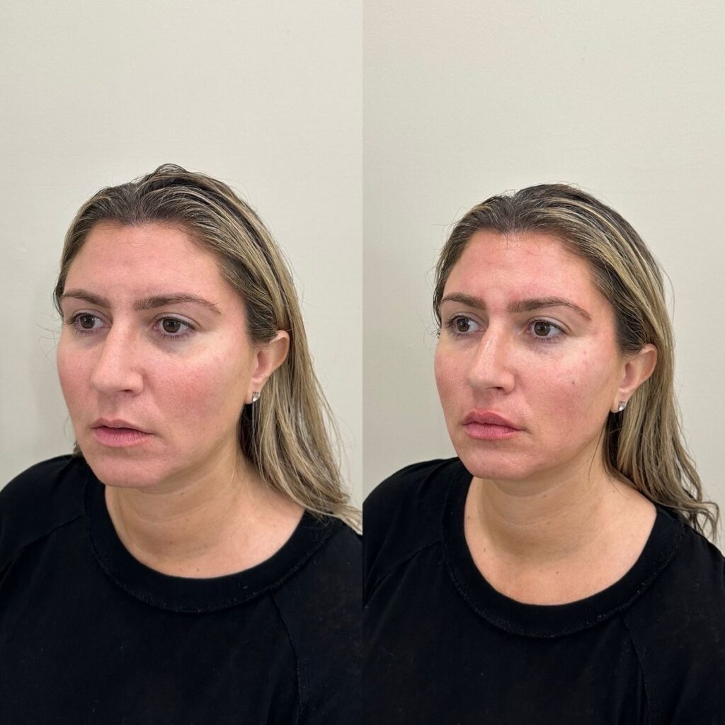 Facial balancing