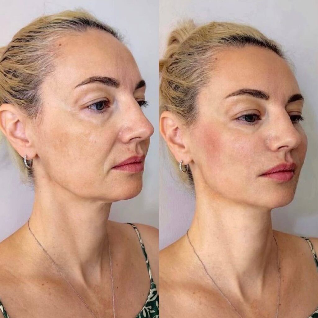 Equilibrio facial