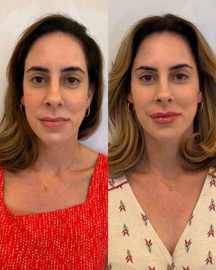 Equilibrio facial