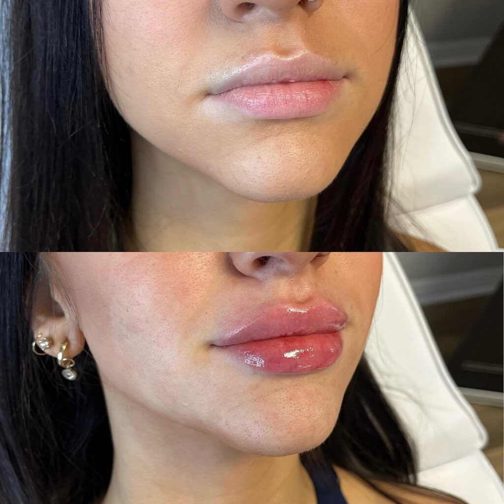 Labios perfectos