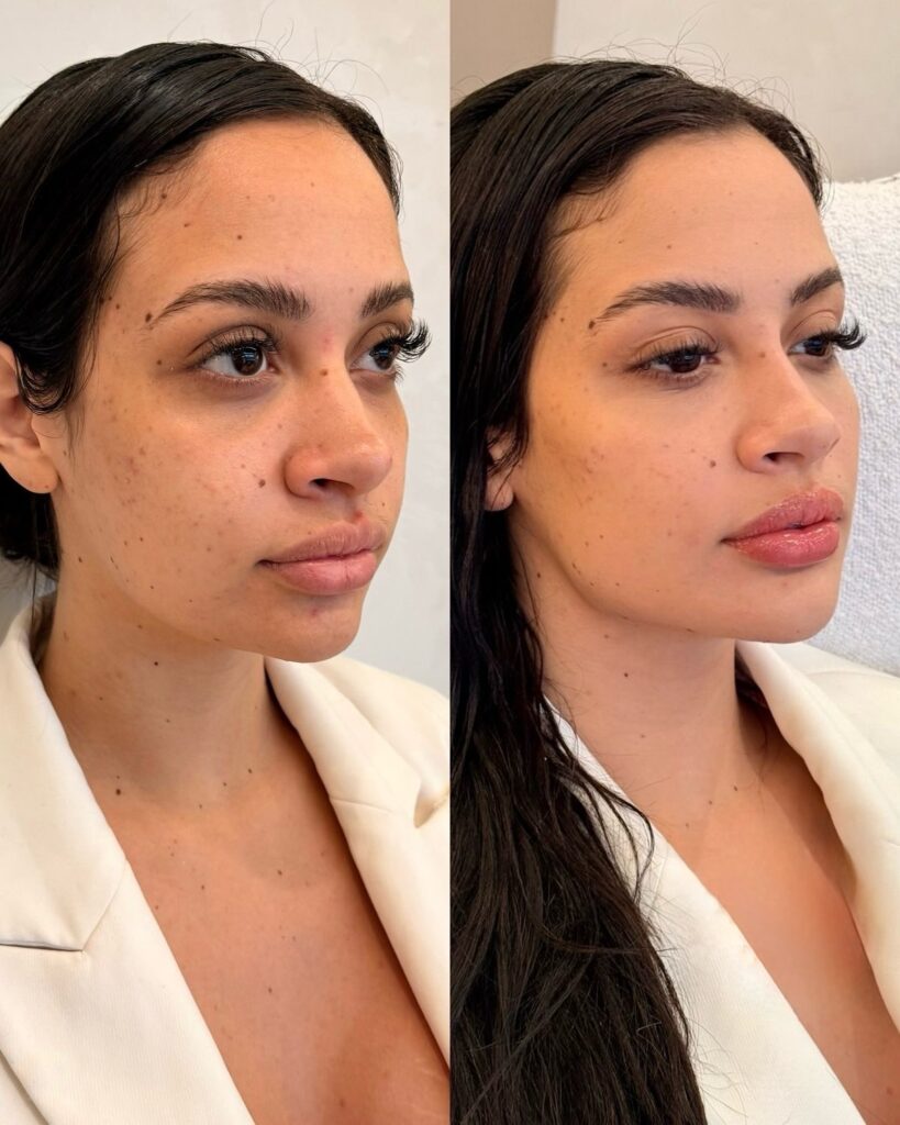 Tratamiento facial completo