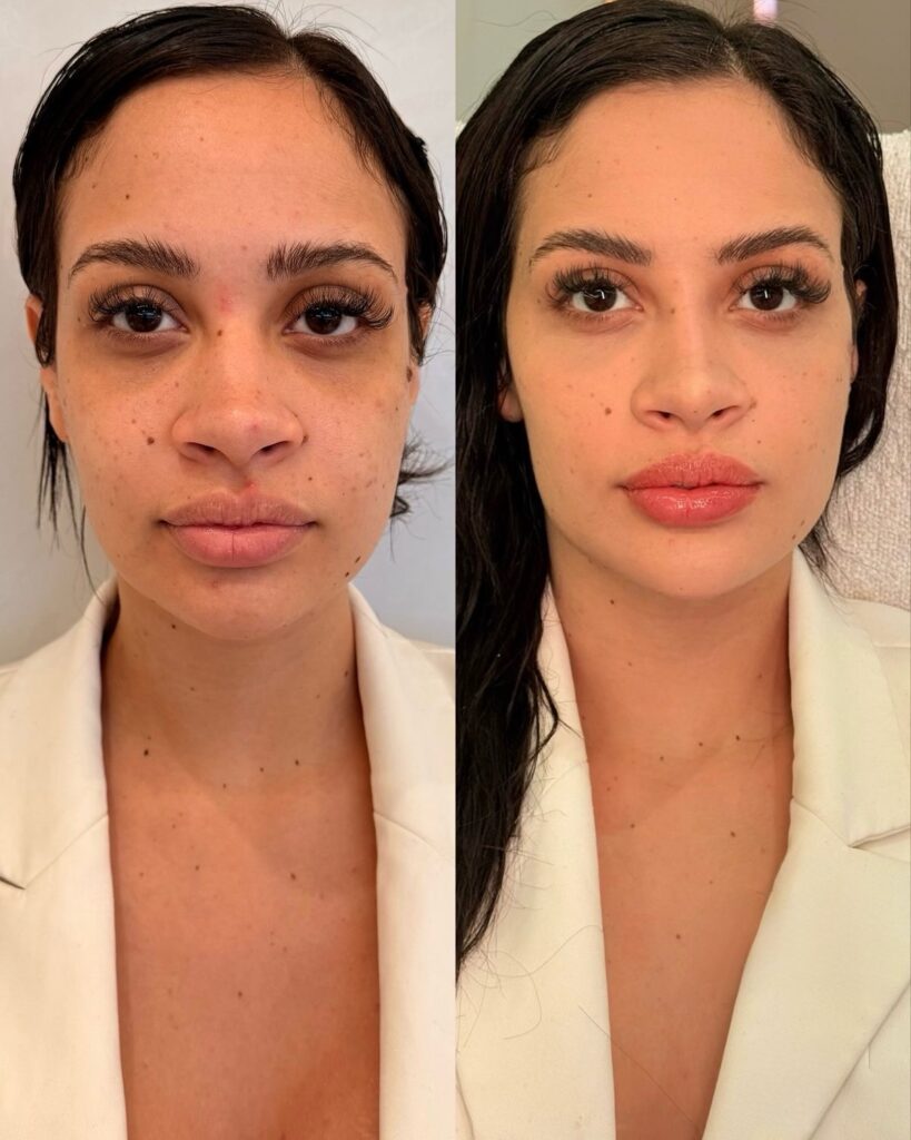 Tratamiento facial completo