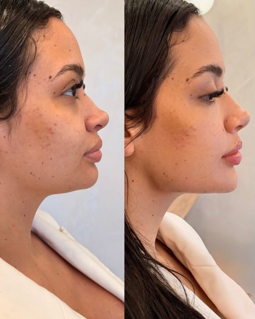 Tratamiento facial completo